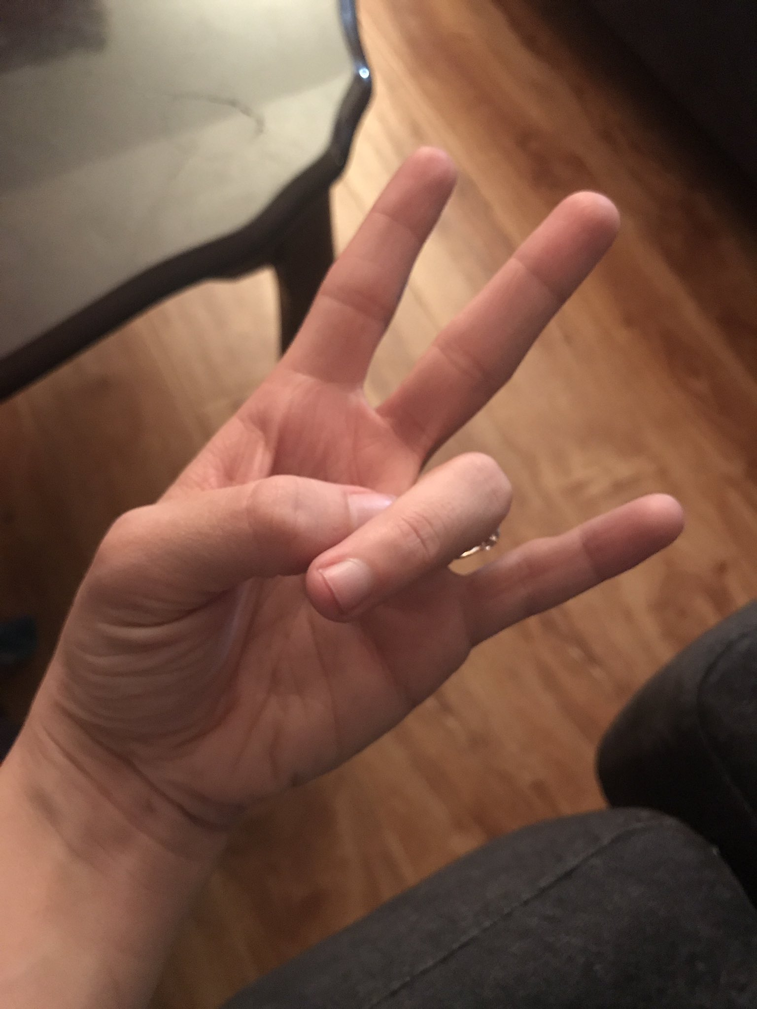The Shocker жест