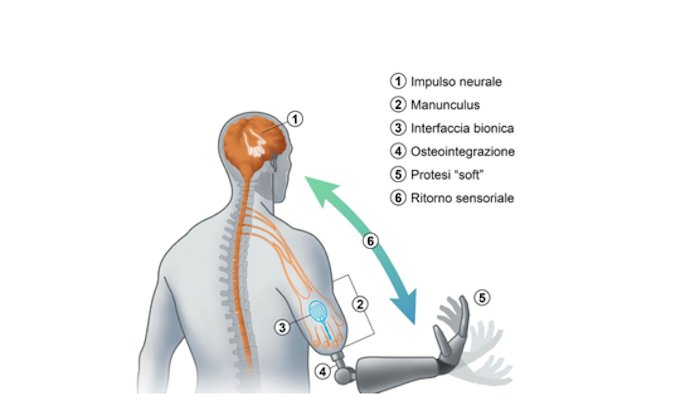 ResearchItaly (@researchitaly) on Twitter photo #Bioniclimbs: from <a href="/IITalk/">IIT</a> <a href="/imperialcollege/">Imperial College London</a> and <a href="/MedUni_Wien/">MedUni Wien</a> a project designed to revolutionize #prosthetics. The 10 million euro fund is a #SinergyGrant of the <a href="/ERC_Research/">European Research Council (ERC)</a> #health #excellence researchitaly.it/en/projects/bi… #Bioniclimbs: from <a href="/IITalk/">IIT</a> <a href="/imperialcollege/">Imperial College London</a> and <a href="/MedUni_Wien/">MedUni Wien</a> a project designed to revolutionize #prosthetics. The 10 million euro fund is a #SinergyGrant of the <a href="/ERC_Research/">European Research Council (ERC)</a> #health #excellence researchitaly.it/en/projects/bi…