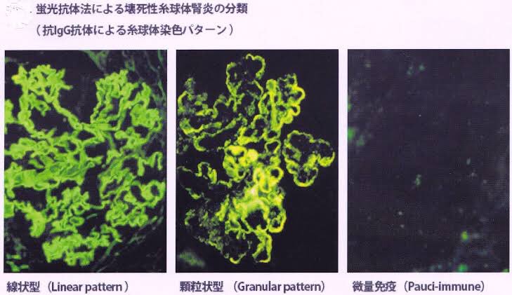 蛍光抗体法 Immunofluorescence Japaneseclass Jp