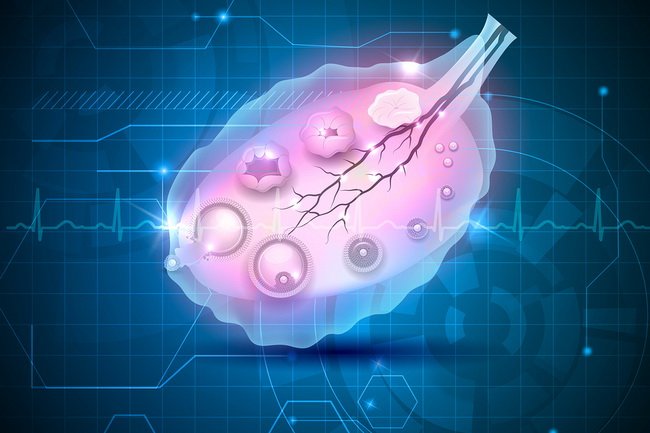 naturaloncom's tweet photo. PCOS: Understanding It and Treating It Naturally https://t.co/hnikZv1cXV #health #women #ovarian https://t.co/IH9pdfkqfh