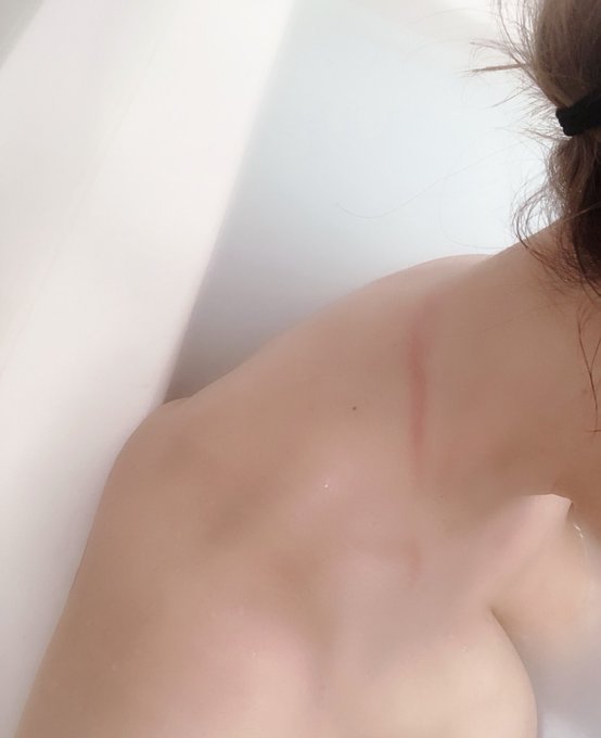 おわかりいただけるだろうか？ 水着の紐の跡。数時間は消えませんw https://t.co/giGNQkhPug<a href="/tag/%E6%84%9B%E7%8A%AC%E3%81%AE%E6%97%A5"class="tags"><span>#愛犬の日</span></a>