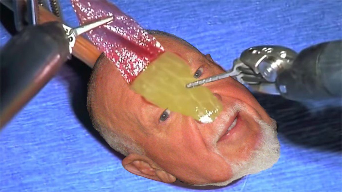 358Noah's tweet photo. They did surgery on a grape. https://t.co/HePJ3zti4t