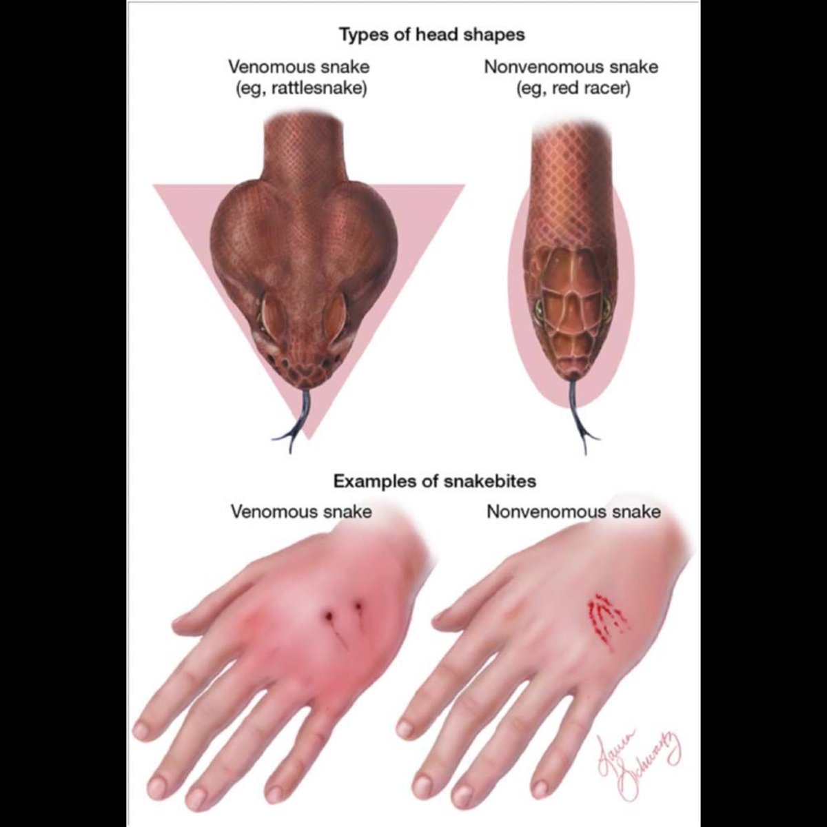 ReviewsRgg's tweet photo. A great way to tell if you’re in trouble just by looking at the snake. 🐍 Sometimes you can’t see what’s bitten you so here’s how to tell if the snake that bit was venomous or not.  An old ER Nurse saying: “Big Head, You’re Dead.” 🐍 ⛑ 
via Randy Elkins #outdoor #survival #snake https://t.co/gryUNsGM3s