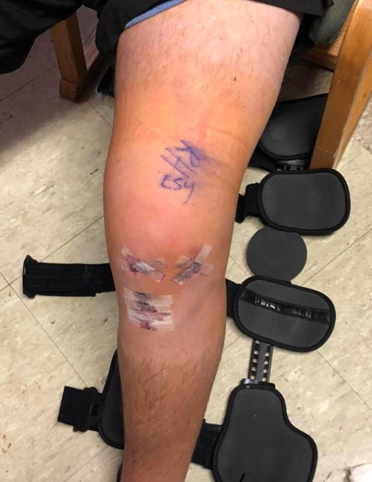 TreyHixon4444's tweet photo. For real I don’t think it’s a joke anymore. Rt or you’ll straight up tear your acl too https://t.co/VoROQSDp9p