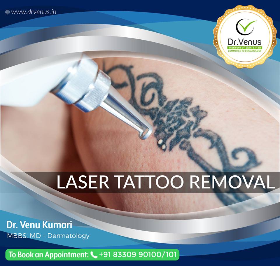 DrVenus4U's tweet photo. Want to remove the tattoo..?

Then get rid of ugly tattoos with Dr.Venus laser tattoo removal treatment

Based upon the skin type one has to undergo with the help of laser: https://t.co/VWb4d93dew

#tattoos
#lasertattooremoval
#tattooremoval
#tattooregret
Hyderabad https://t.co/503J9WpTJn