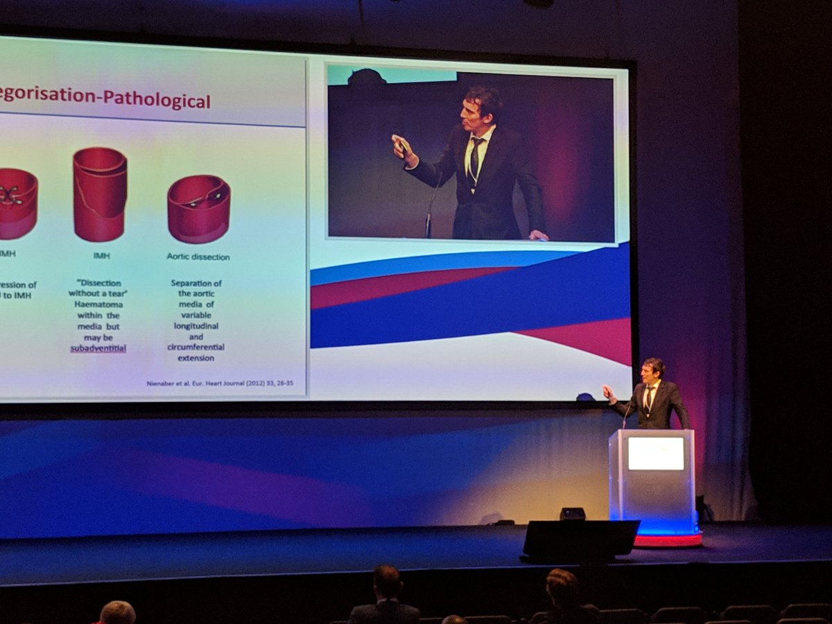 ImperialVasc's tweet photo. Colin Bicknell (@Colinbicknell) presenting on optimum management pathways for acute thoracic aortic pathology #VSASM18 #VSASM2018 https://t.co/Sy786sUEwh