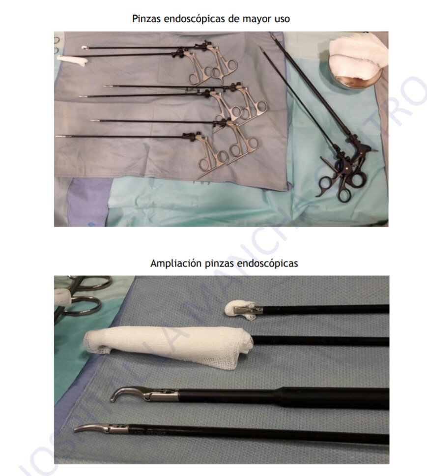 EnfermerosA's tweet image. ⏩Cirugía Bariátrica: Obesidad Mórbida 
➡Y de Roux o bypass gástrico  ➡Gastrectomía Vertical
Técnicas, Preparación del Paciente y Quirófano e Instrumentación 😷
#EnfermerosQuirófanoAlcázar #GuíasQuirúrgicas #AprenderYCompartir @charo_79 @AeeqSpain

▶docs.wixstatic.com/ugd/655e88_994…
