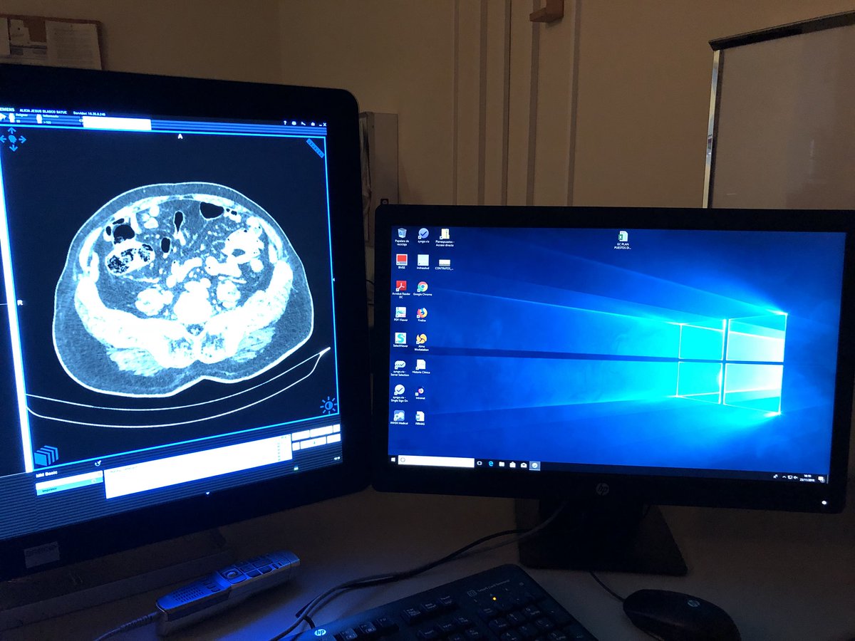 jftrebolle's tweet photo. Recogiendo nuevos casos para @unitomia. Y trabajando con @ccmijesususon en nuevas ideas de aplicación de #RealidadAumentada y #RealidadVirtual. Os las presentamos muy pronto!!! https://t.co/iwSueLdfnV