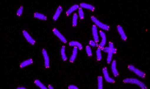 oncocheck's tweet photo. #MustRead: Utero stress exposure as a significant predictor of subsequent adult #TelomereLength via University Hospital of Larissa 🔬✨#Stress #FemaleReproduction #Pregnancy https://t.co/VEqOW4RO8V https://t.co/AQUxSkpVz6