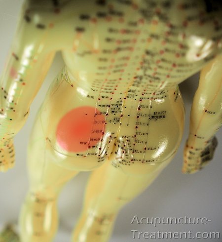Acupuncture T tweet media