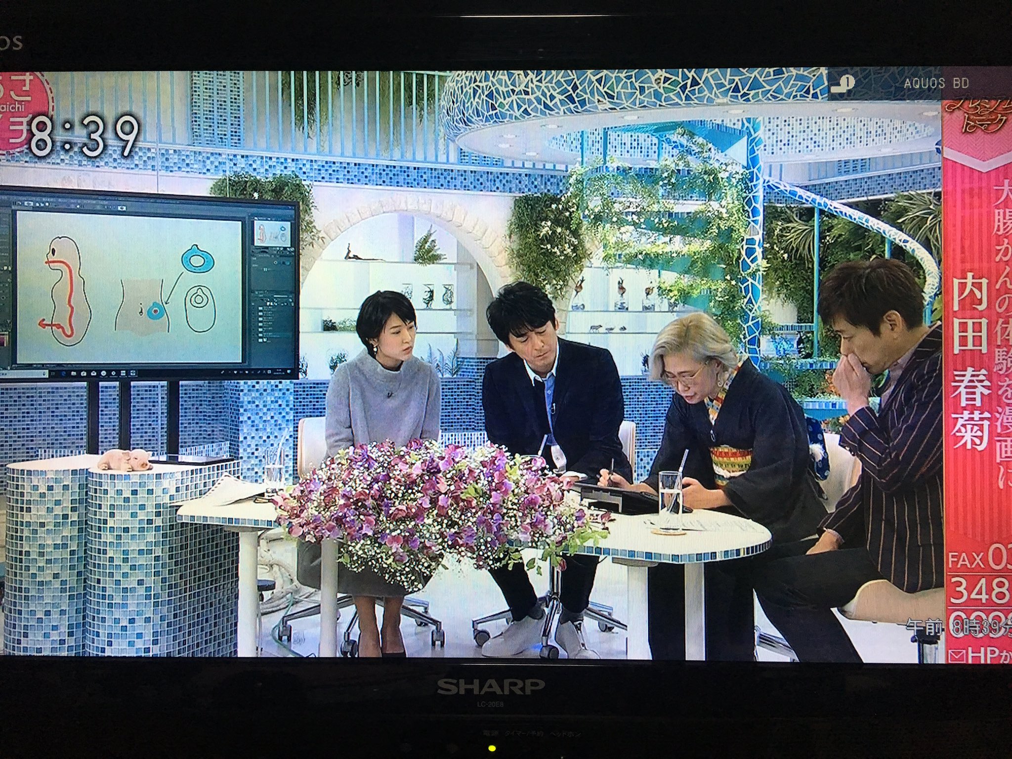 画像 あさイチ 内田春菊さんが 人工肛門にされた経緯を漫画化した話から 人工肛門ってどんな感じなの ってぶっちゃけ話を 分かりやすくその場でイラスト描きながら説明さ まとめダネ 画像 あさイチ 内田春菊さんが 人工肛門にされた経緯を漫画化した話から 人工肛門ってどんな感じなの ってぶっちゃけ話を 分かりやすくその場でイラスト描きながら説明さ まとめダネ