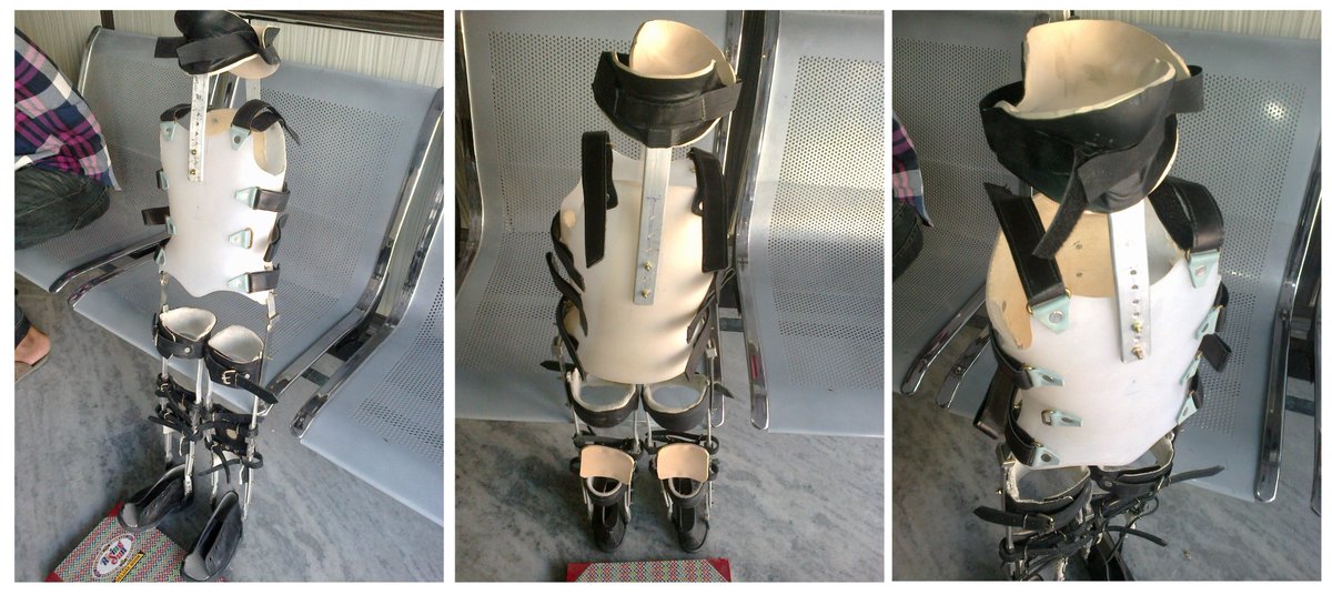 mycaremedical's tweet photo. CTHKAFO brace cervical thoracic hip knee ankle foot orthosis for full body support. #cthkafo #hkafo #kafo #fullbodysupport #cervicalsupport #orthoticsupport #fullbodybrace #mycareprostheticsandorthotics https://t.co/sh9Ls5aIHl