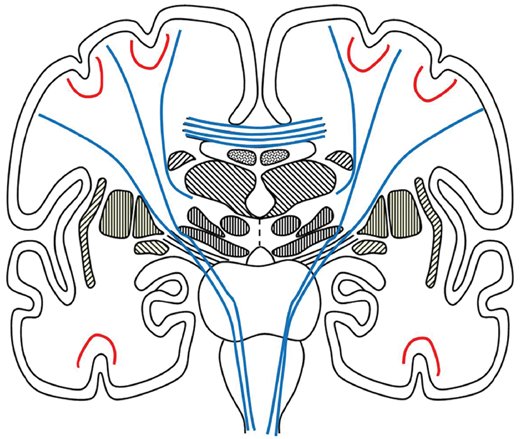 Brain1878's tweet photo. Brain connections and social connections in autism spectrum disorders. New scientific commentary by Lisa Eyler https://t.co/U7wHBsPziz https://t.co/CC6k8huUy2