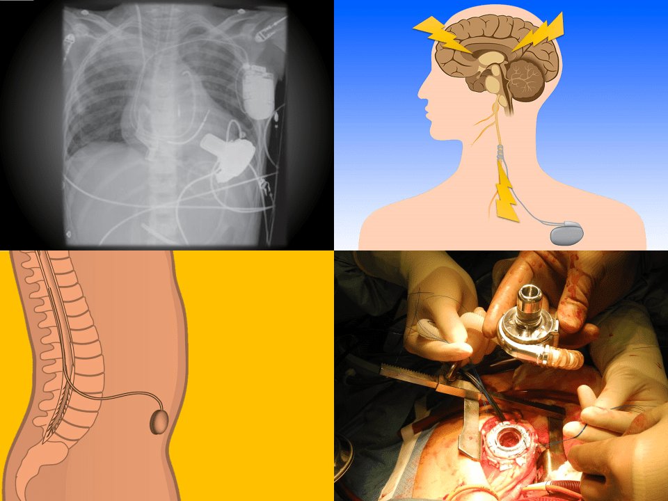 emdocsdotnet's tweet image. PEM Playbook – The Higher Tech Kid in the ED by @EMTogether
#FOAMPed #FOAMed #TechKid emdocs.net/pem-playbook-t…