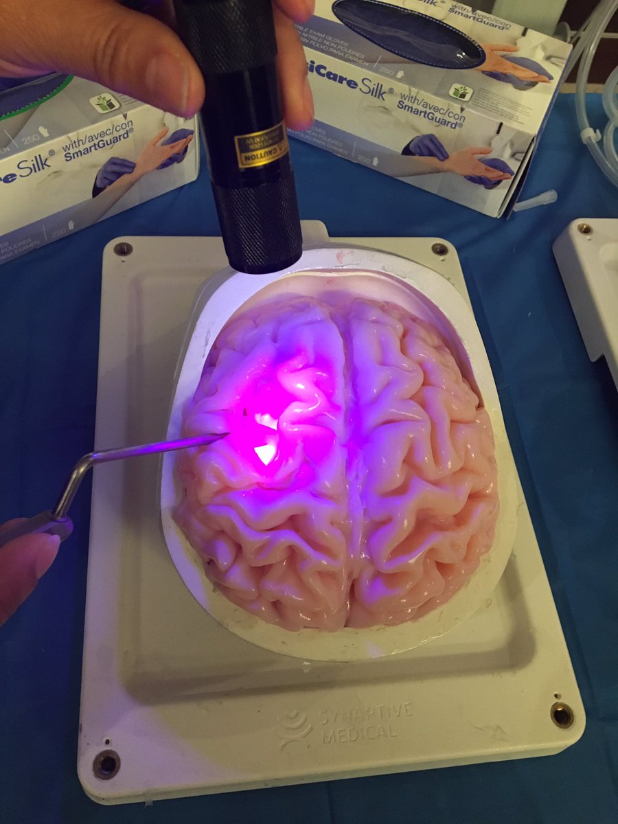 MountSinaiNeuro's tweet image. Break with our exhibitors at the #5ALAFGS #BrainTumor Symposium at @MountSinaiNYC! #ORtech #MedTech @neurosurgery @NSTumorSection