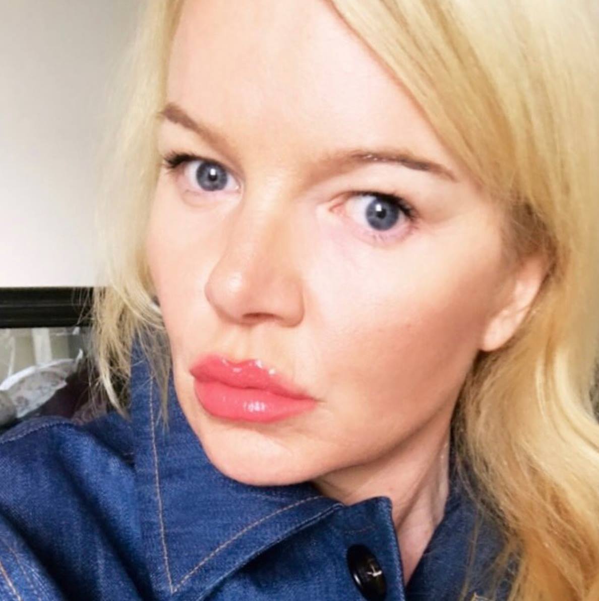VisageClinic's tweet photo. "My skin keeps getting better daily and that’s the astounding part - I’m still seeing changes, like reduced texture and pore size, my wrinkles are way less and my skin is just plumper everywhere!" Read about @CatForsley's full #HaloLaser experience at https://t.co/WlwW7HRfL6!✨ https://t.co/1jUwuruqMs