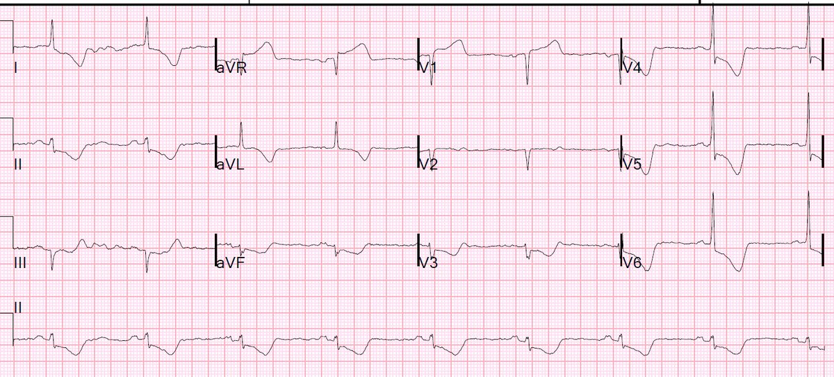 smithECGBlog's tweet photo. The 4 Physiologic Etiologies of Shock, and the 3 Etiologies of Cardiogenic Shock  https://t.co/tEifei4iDq https://t.co/CAdScr3ZZw