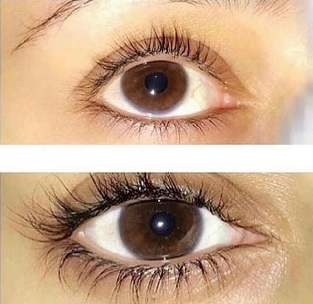 بنات بعد ماتوصلون للنتيجة المطلوبة⚠️

 اقطعوا المنتج تدريجياً ، مب مرة وحده يعني يوم حطي و يوم لا تحطين عقبها يوم حطي يومين لا تحطين و الخ و بعدها اقطعي المنتج عشان تحافظين على النتيجة 👁💕