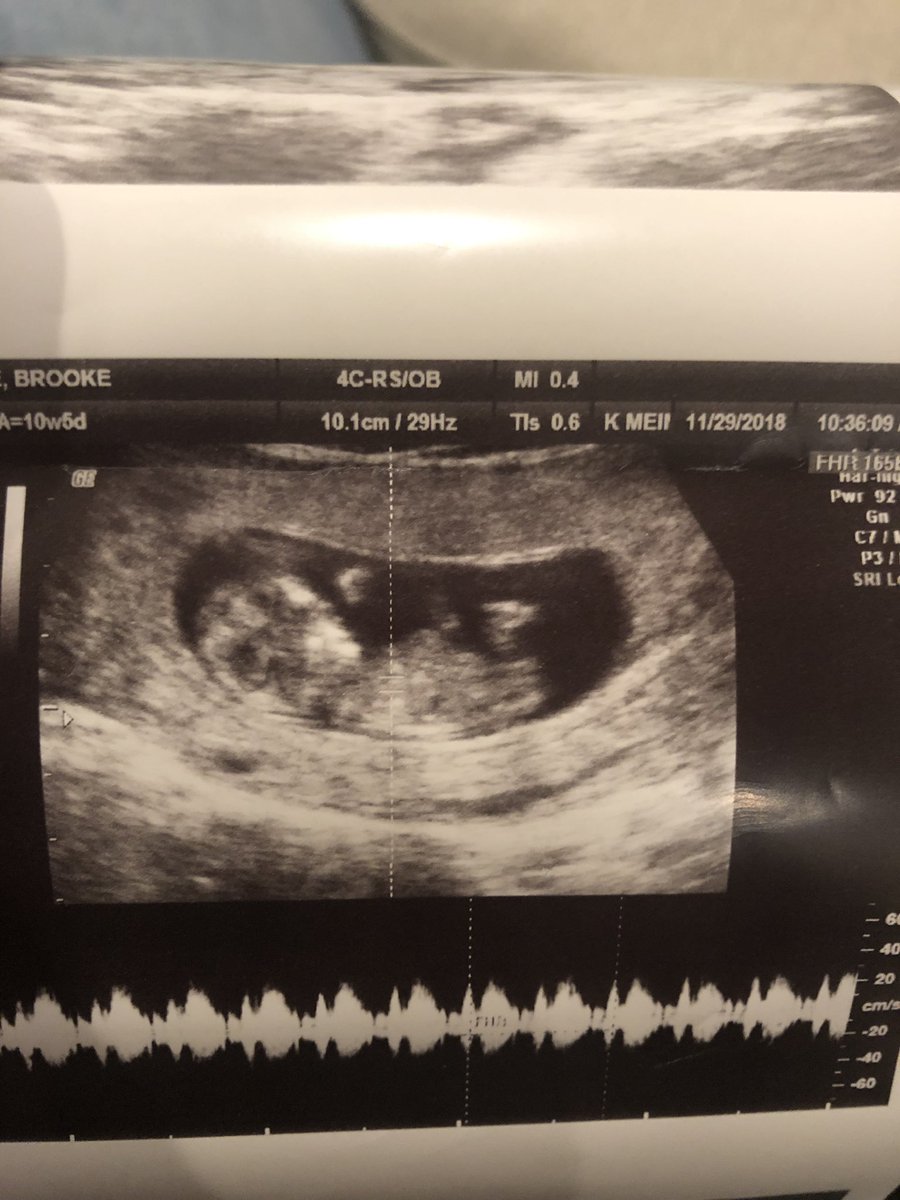 YoitsWinnie's tweet photo. After 9 years of adventures with my best friend @BrookeWinnie1 , containing countless dates, 2 Proms, many vacations, and one wedding. Next year comes our biggest adventure yet! Arriving June 13th,  #BabyWinchester , mark your calendars! https://t.co/YDttidDauV