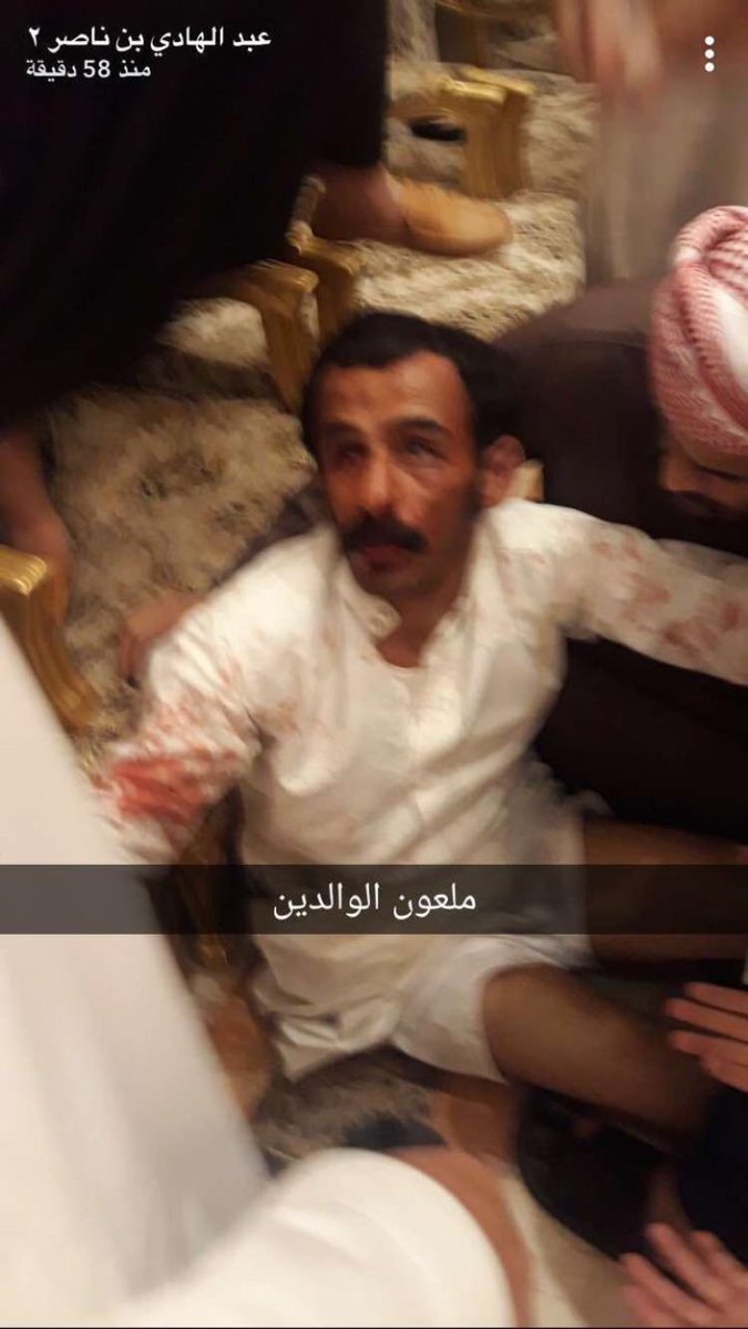 aborashaea011's tweet photo. @sszz134 فيديو يوثق لحظة طعن العريس
شاهد الفيديو واحكم بنفسك 

هنا +18 :  https://t.co/KU7x0C9Ofk 

#َطعَن_عريًس_فُي_خميُْس_مًشيط https://t.co/Y2aVml3zaE
