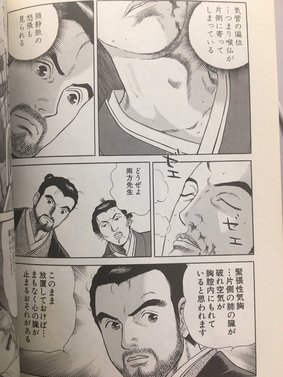 神漫画『仁』を読み直してるんだけど、南方先生は採血や画像検査等なく病歴と身体初見だけを頼りに迅速に緊張性気胸や慢性硬膜下血腫を診断していて、病歴聴取と身体診察がいかに大事かを再確認したしこれからは江戸時代にタイムスリップした気持ちでファーストタッチするか 