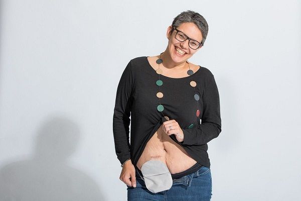 scope's tweet photo. "To the woman who tutted at me for using an accessible toilet" @so_bad_ass looks back on the experience of being judged for using an accessible toilet with an invisible impairment. https://t.co/E4btlxPXBw https://t.co/0qk3Kwzjm0