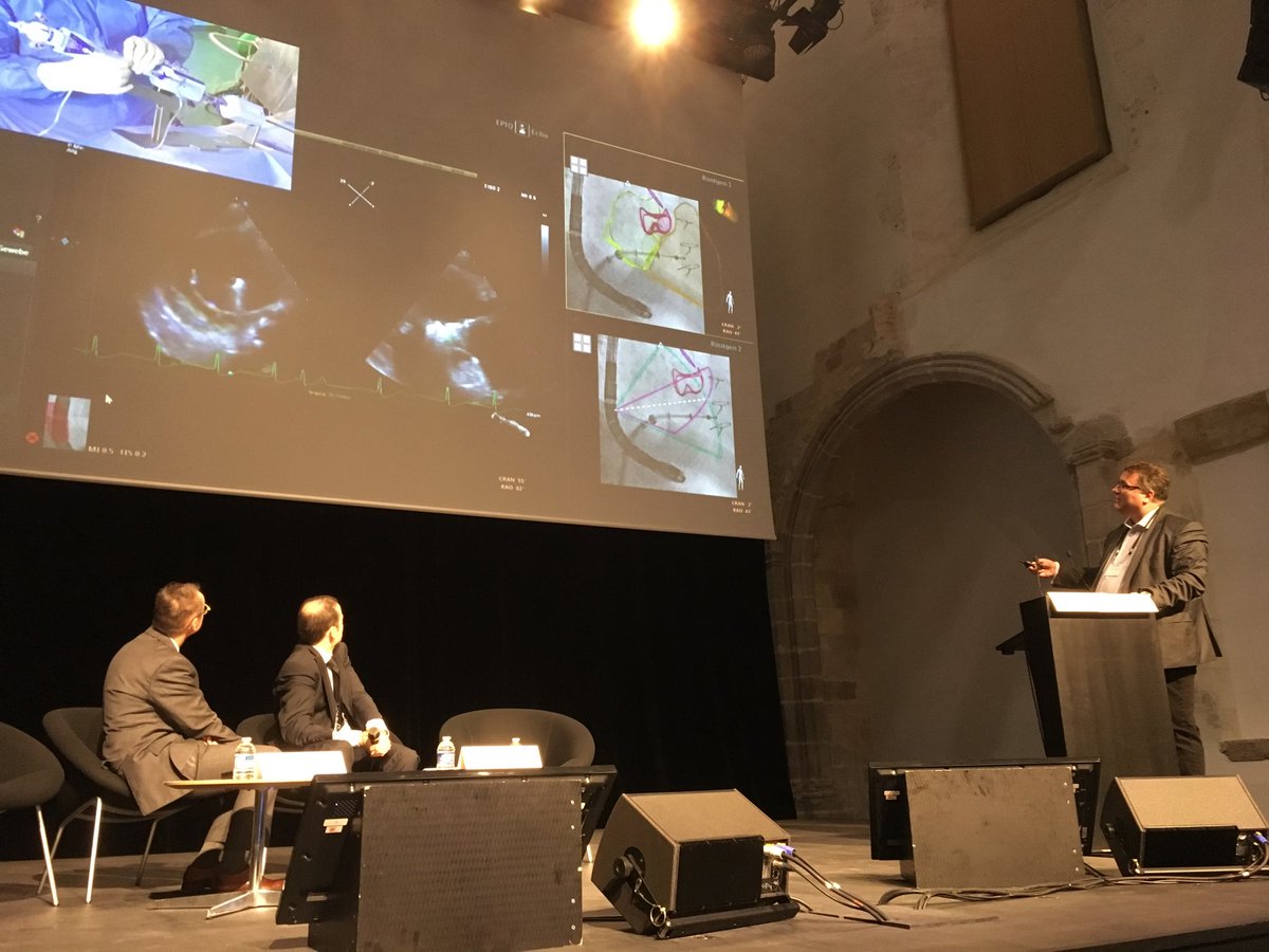 French PMVR Traitement des fuites tricuspides TRAP registre de la filiale d’imagerie // tricclip pour le traitement comment fait-on, RS von Bardeleden show👍#Paris echo 19@filiale echo