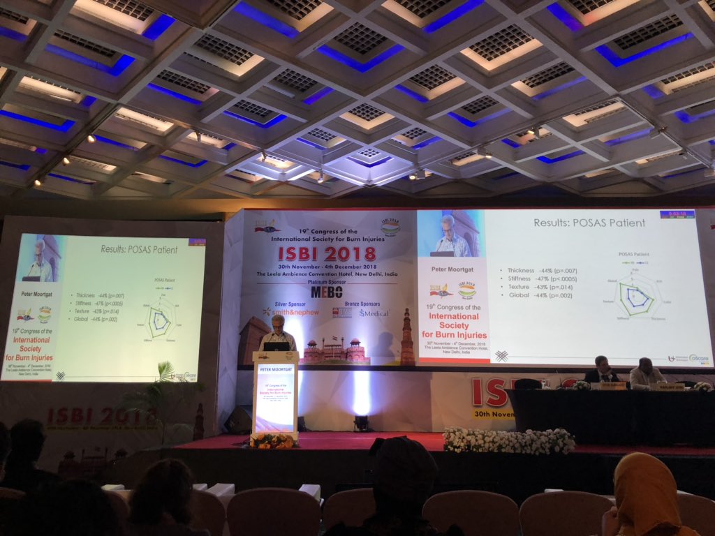 Claire van Hรถvell tot Westerflier (@clairevanhovell) on Twitter photo Microneedling is a safe, painless and very affordable way of improving scar quality in burns patients, as shown by <a href="/petermoortgat/">peter moortgat</a> <a href="/koenmaertens/">Koen Maertens</a> <a href="/vzwOscare/">OsCare vzw</a> #IBSI2018 #microneedling <a href="/POSAS_group/">POSAS</a> Microneedling is a safe, painless and very affordable way of improving scar quality in burns patients, as shown by <a href="/petermoortgat/">peter moortgat</a> <a href="/koenmaertens/">Koen Maertens</a> <a href="/vzwOscare/">OsCare vzw</a> #IBSI2018 #microneedling <a href="/POSAS_group/">POSAS</a>