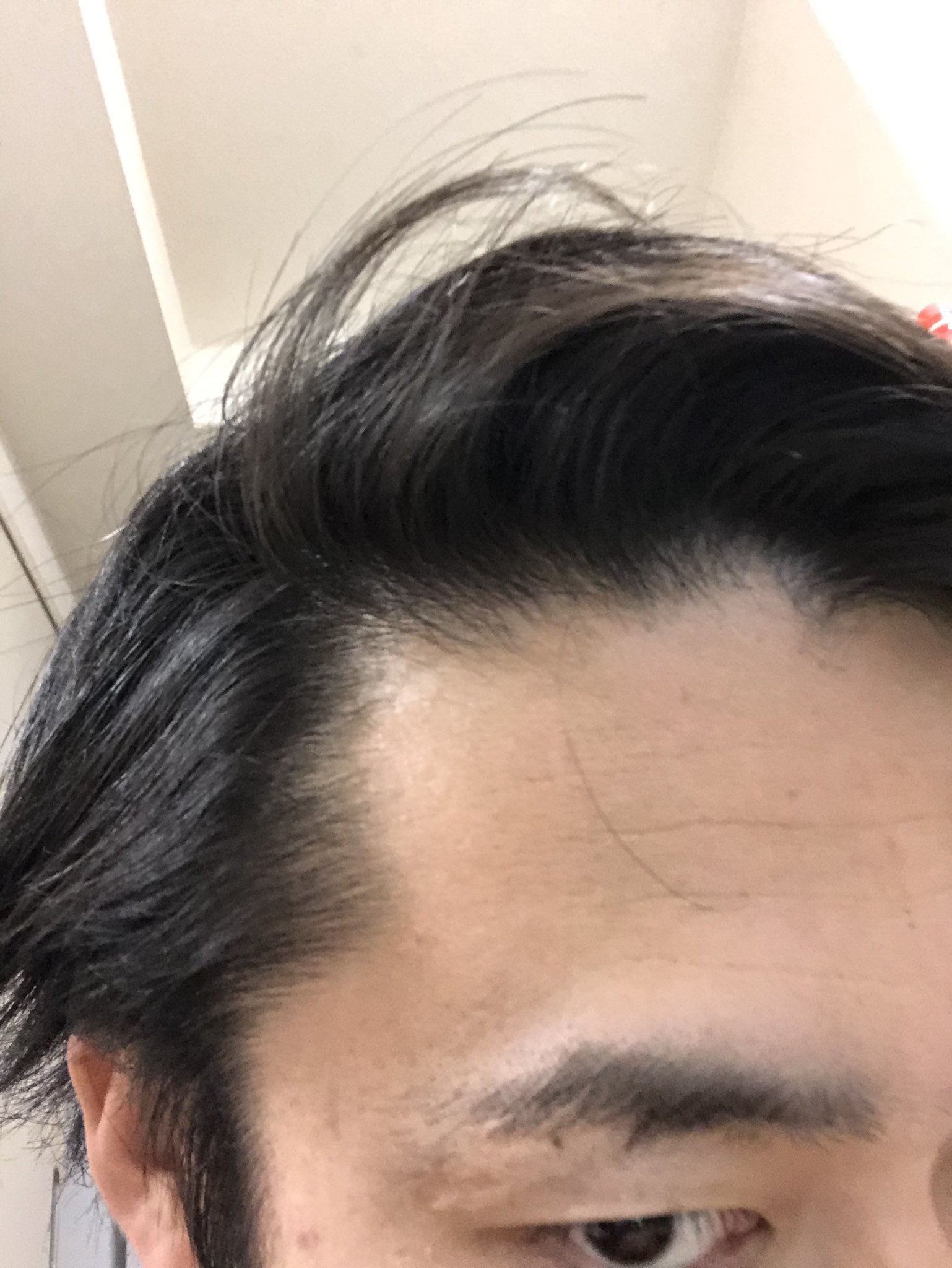 シルクロード Fischer S M 1おもろかったなぁ 記憶に残ってまたみたい芸人さんが多すぎたなぁ 霜降りさん年近くてビックリ テレビからの笑いの旋風で 髪が後退した