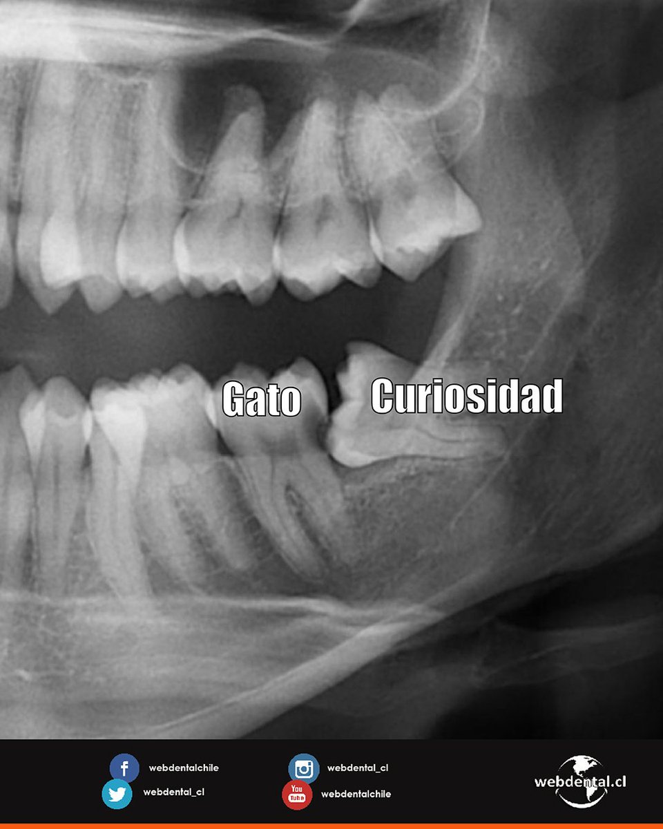 webdental_cl's tweet photo. ยฟA quiรฉn invitarรญas a matar la curiosidad? ๐
--
#webdentalROCKS ๐ค๐ฉ๐ธ
#webdental_cl
#webdental
#odontologia https://t.co/M2BniFrIj0