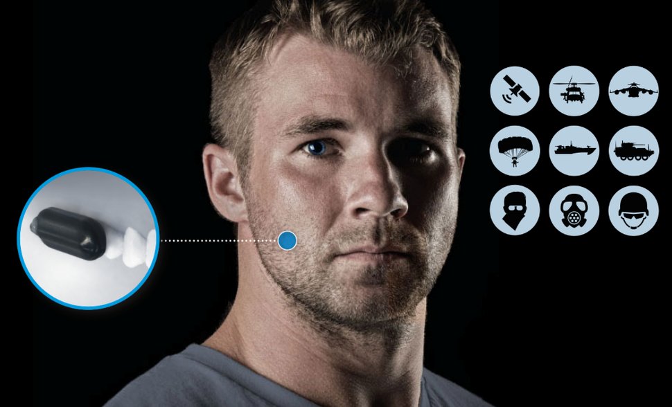 BeatsBones's tweet photo. Molar mic... spreken via de tanden dankzij bone conduction! #beatsandbones #boneconduction #koptelefoon
https://t.co/VccPzEE7j7 https://t.co/fIlfjSiELd