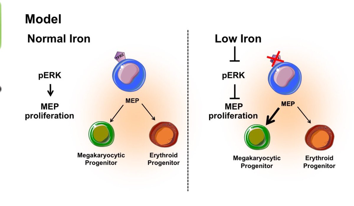 TeamHaem's tweet photo. Why do you get high platelets with iron deficiency? Juliana Xavier-Ferrucio  #ASH18 https://t.co/B6wxV6U6up