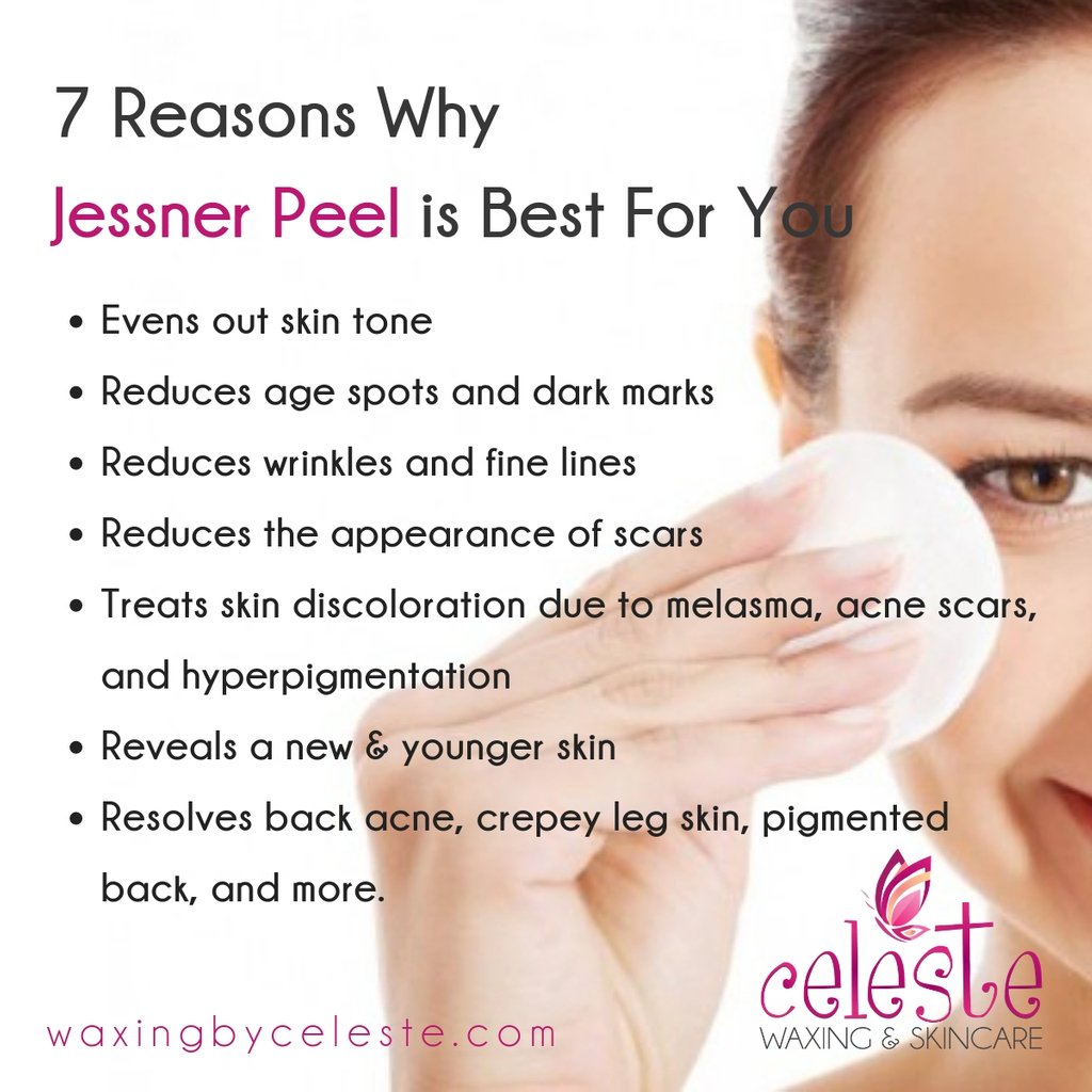 Experience the wonder Jessner Peel can do to your skin.

Book your appointment online or call us at (619) 495-2904. ☎️
.
.
.
#waxingbyceleste #jessnerpeel #sandiegoskincare  #microdermabrasion #facialtreatment #acnetreatment #skincareformen #skincareforwomen
