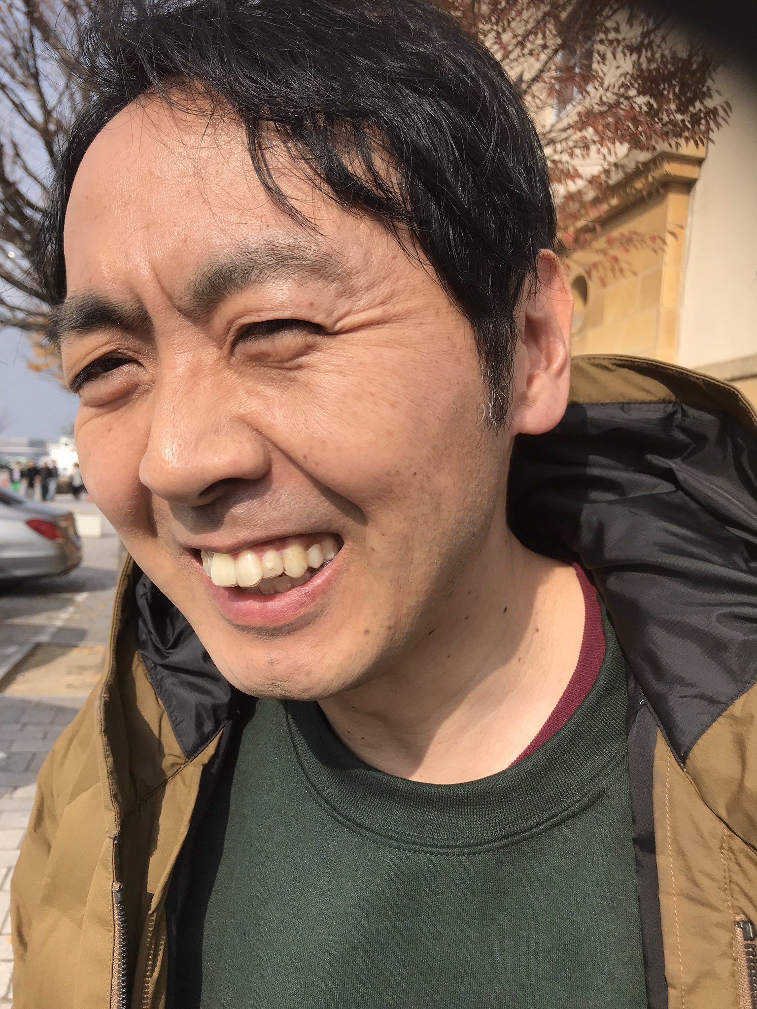アンガールズ 田中 歯並び