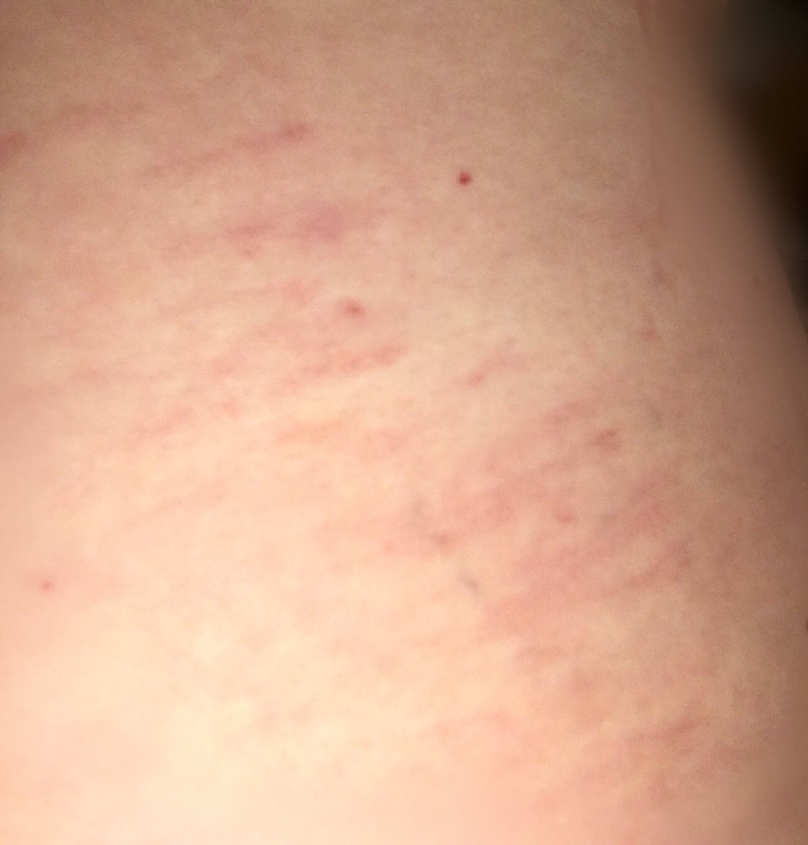 And some guests come up with very detailed &amp; well prepared role plays. They handcraft their own corporal punishment instruments and -with explicit consent!- leave marks still visible one week later 😍 #naughtygirlluckygirl