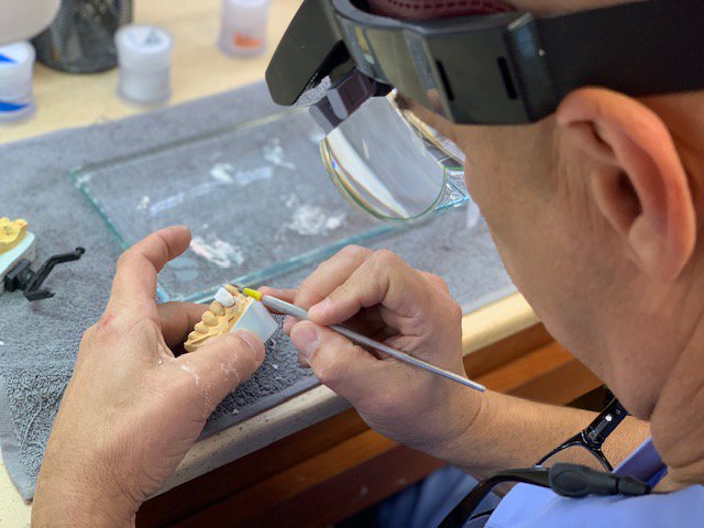 We love our digital workflow, but we also love adding details by hand. Our technician, Frank, is truly an artist. 

#digitaldental #digidentlabs #dental #dentist #dentsplysirona #inlab #cerec #cerecconnect #digitaldentistry #design #cadcam #technology #layering #artistictouch