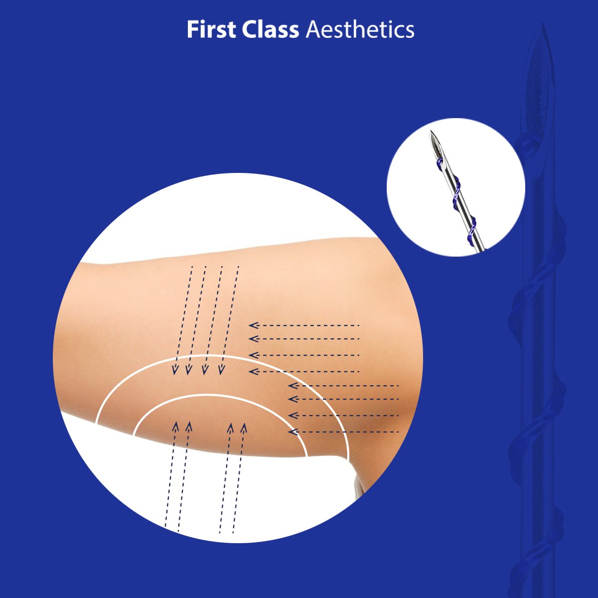 1stClassThread's tweet photo. Non-Surgical body contouring with 1st Class Threads. https://t.co/Ko8Wx0nv3A