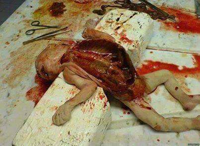 Vahşi batılılar, müslüman çocukların bütün iç organlarını çıkarıp zengin ve yaşlı avrupalıların vücuduna takıyorlar. Bunların insanlığı bu işte. İnsanlığın ve vicdanın ölmemiş ise lütfen PAYLAŞ.