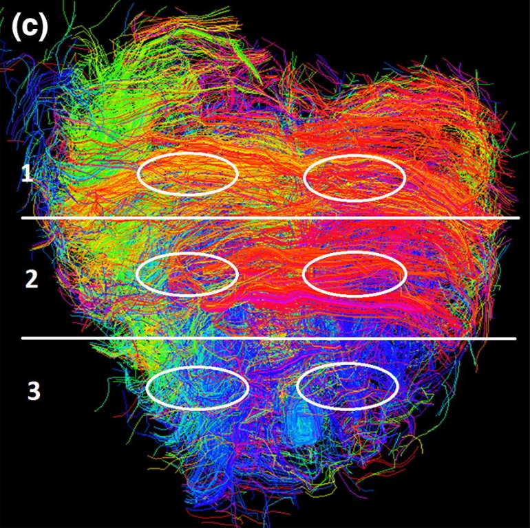 ABMEjournal's tweet photo. Congratulations Faizan Ahmad for having your research on neonatal heart microstructure featured on our December cover! @petertheobald @EngineeringCU @BMESociety @SpringerNature

https://t.co/r6360J7vm0 https://t.co/5uqjHI6W3z