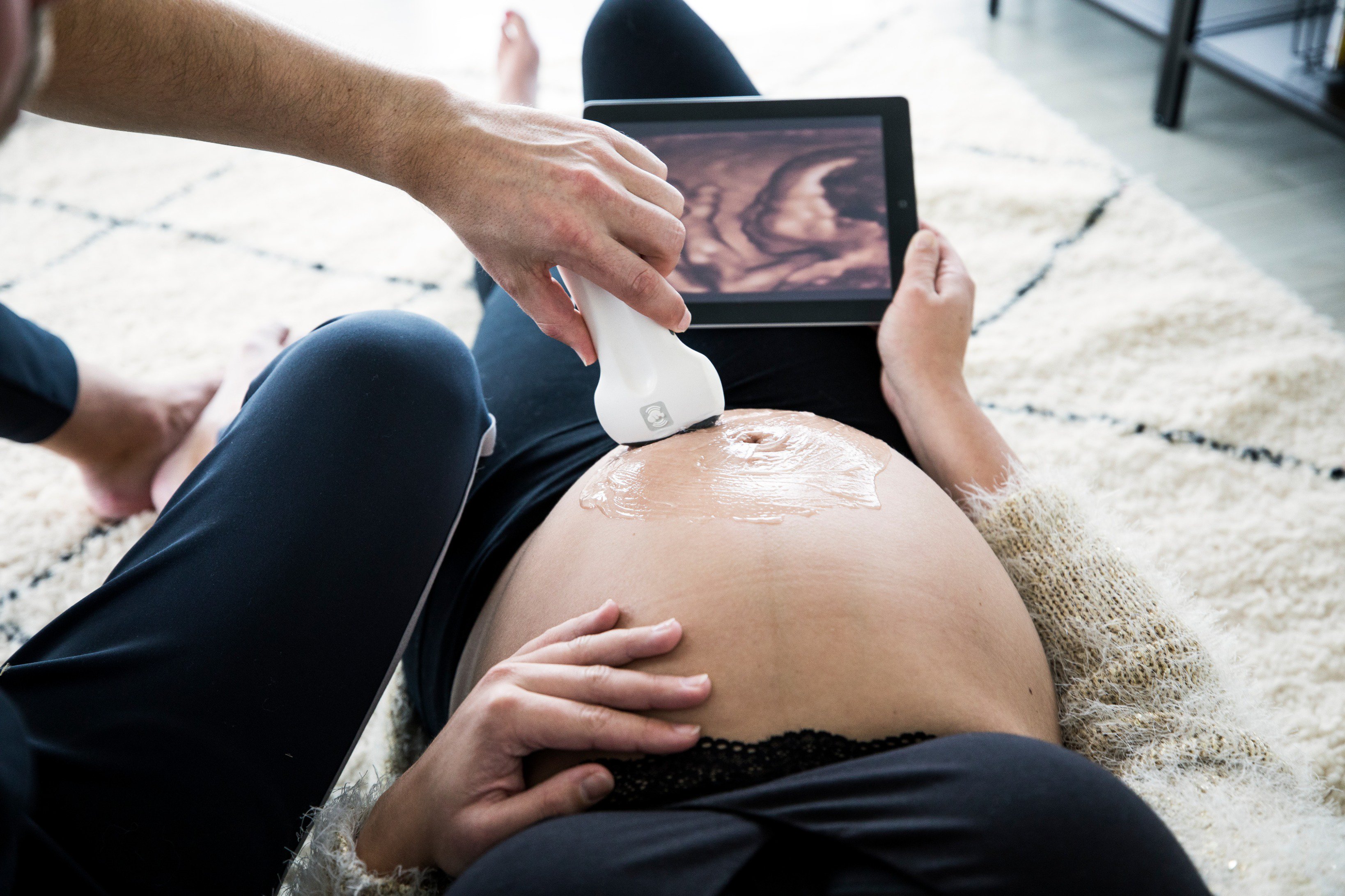 Baby-Scan on Twitter: "In January we launch the world's first 2D and 3D ultrasound scanner home use! #babyscan #launch #newtechnology # ultrasound #firsttweet #mijneerstetweet #pregnant #pregnancy #Tweet babies https://t.co/8Kl7e33MP2" / Twitter