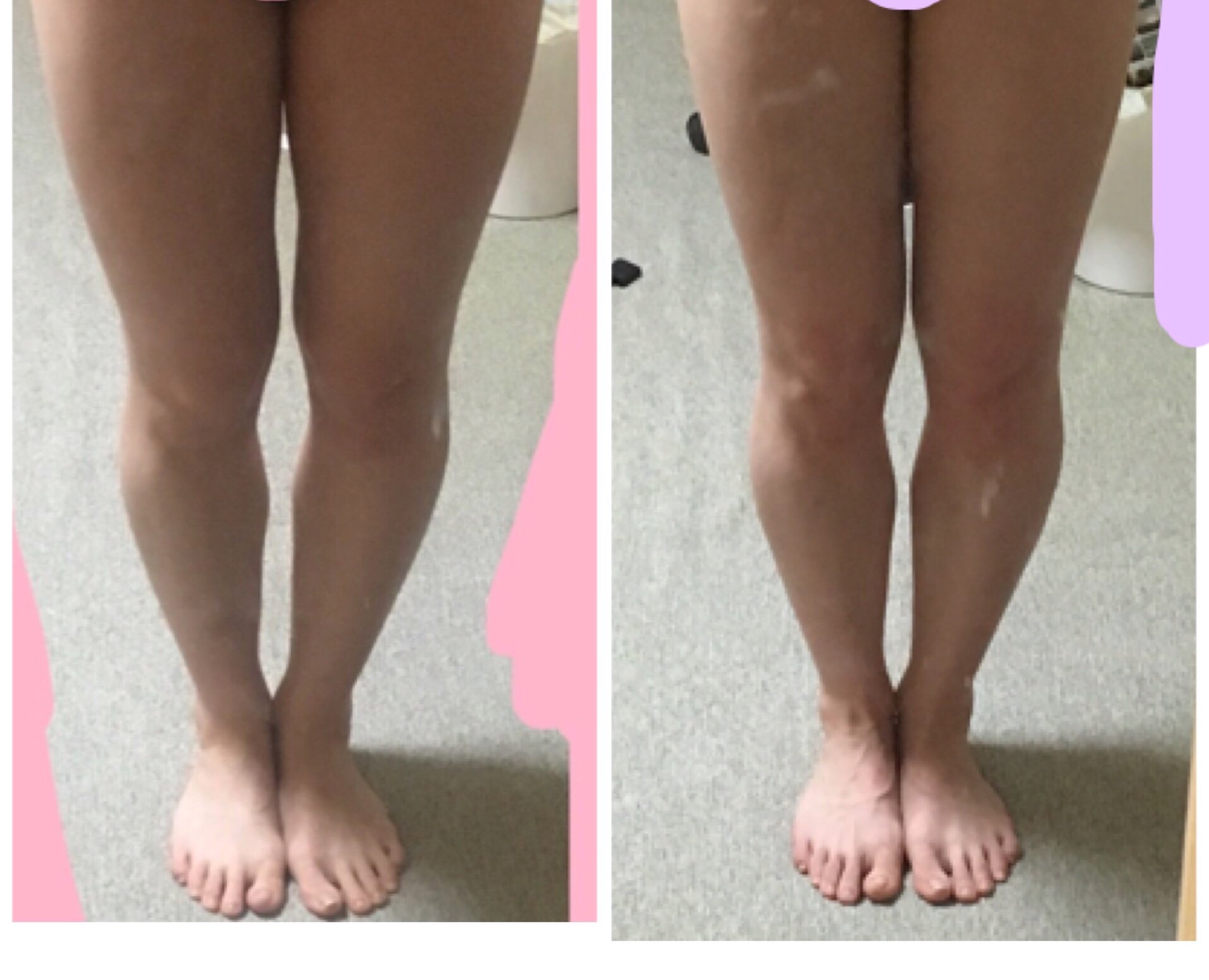 なお 脚やせ祭り Qictqpi5rjmfc7v Twitter