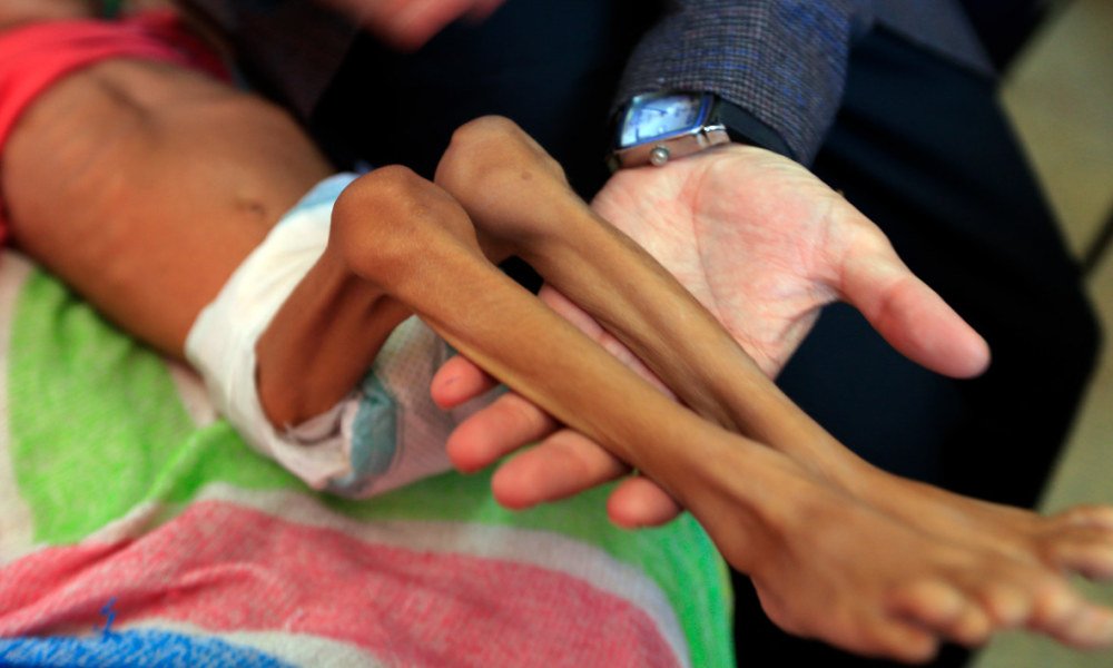 BFMTV's tweet photo. Environ 80% des Yéménites ont besoin d'aide humanitaire

https://t.co/A832YviVTI https://t.co/hoELU4Fqn5