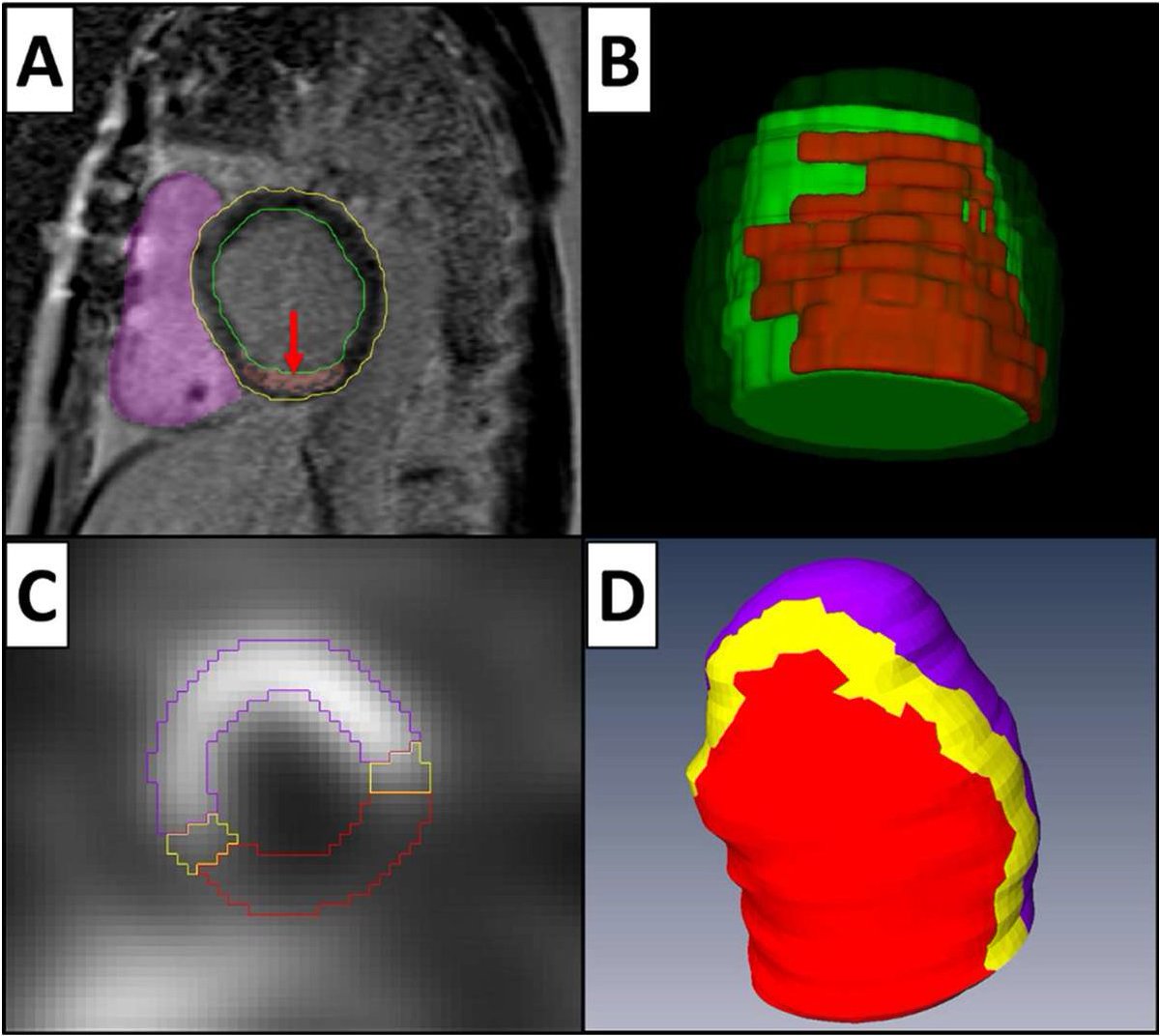 University of Maryland Cardiology tweet media