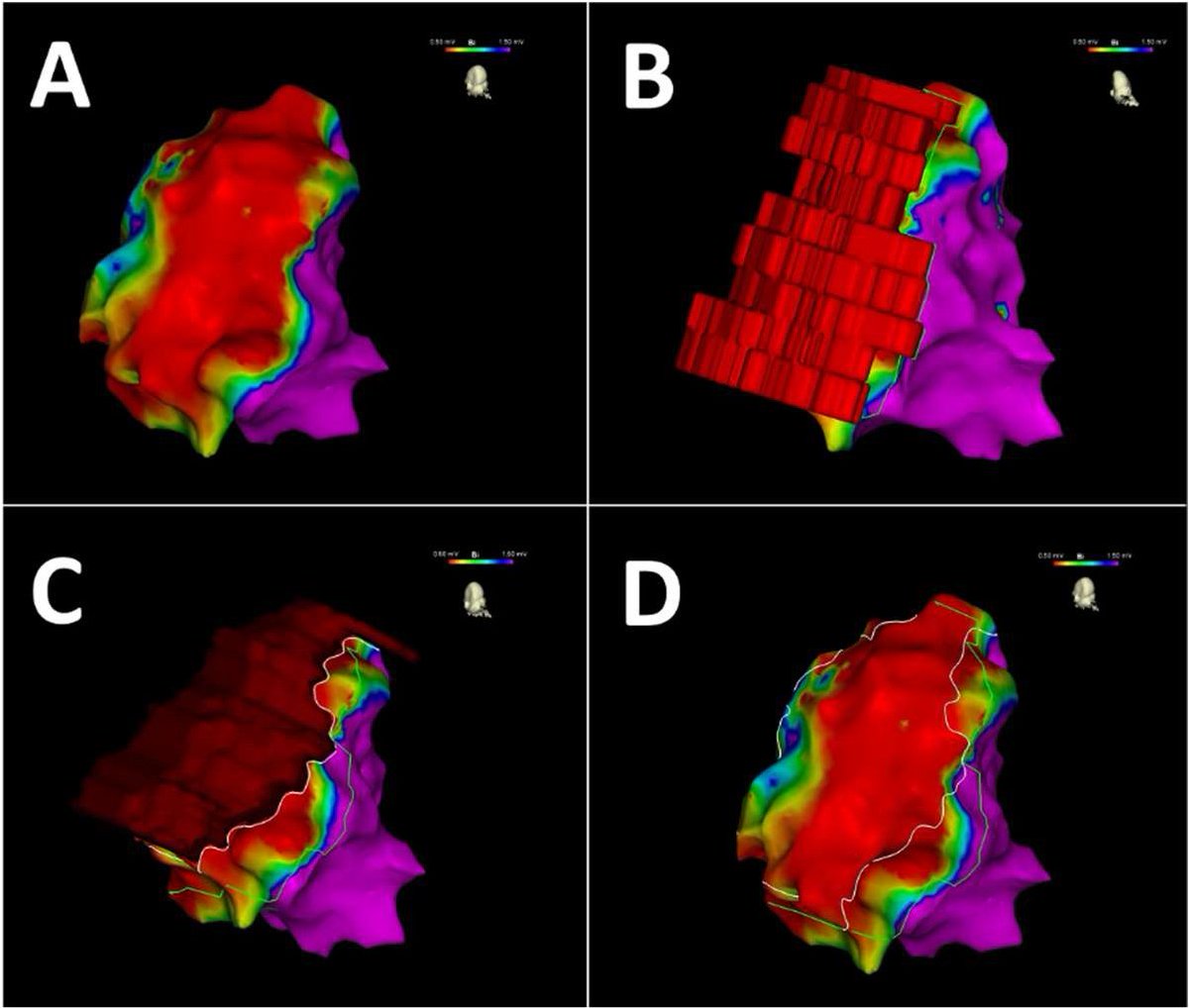University of Maryland Cardiology tweet media