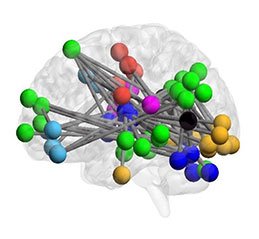 NIH_Innovates's tweet photo. NIMH-funded scientists have discovered that hyperconnectivity in a circuit involving the cerebellum, thalamus, and cortex may be a “neural signature” of impending psychosis. https://t.co/nRQLOiTFuZ https://t.co/537Htdt0lJ