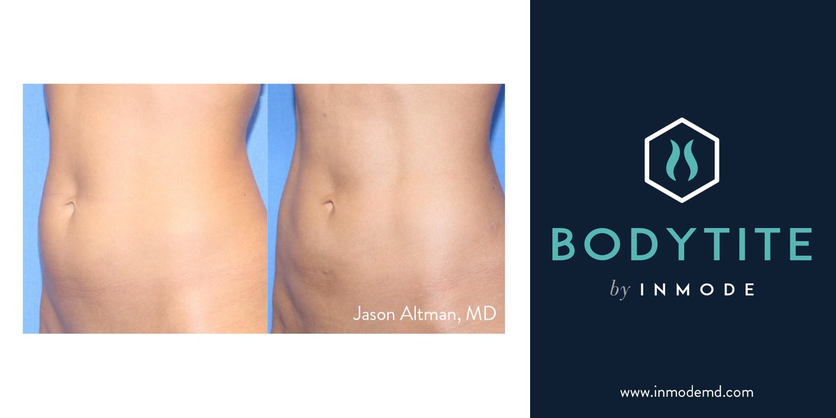 Surgical results, without #plasticsurgery. Learn more about #face and #bodycontouring. bit.ly/2QZcx6e #DFW
