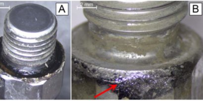 jbjs's tweet image. Corrosion has been documented in modular knee implants, but it has not been related to negative patient outcomes. hubs.ly/H0fMSCQ0 #JBJSOpenAccess