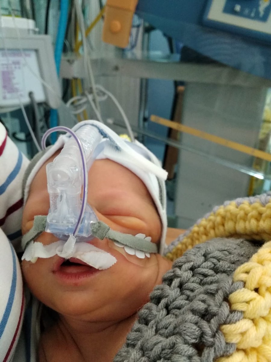 Como en mi TL hay gente tan maja, aquí os presento a mi sobrino Miguel, con dos días y peleando por la vida, para que os echéis unos rezos por él