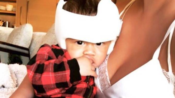 globalnews's tweet photo. "Don’t feel bad for him," @ChrissyTeigen tweeted about her son's "adorable slightly misshapen head.”
The message prompted other parents to share #helmetsquad photos.
https://t.co/zqCjHURJji https://t.co/K5NH2SNLMw