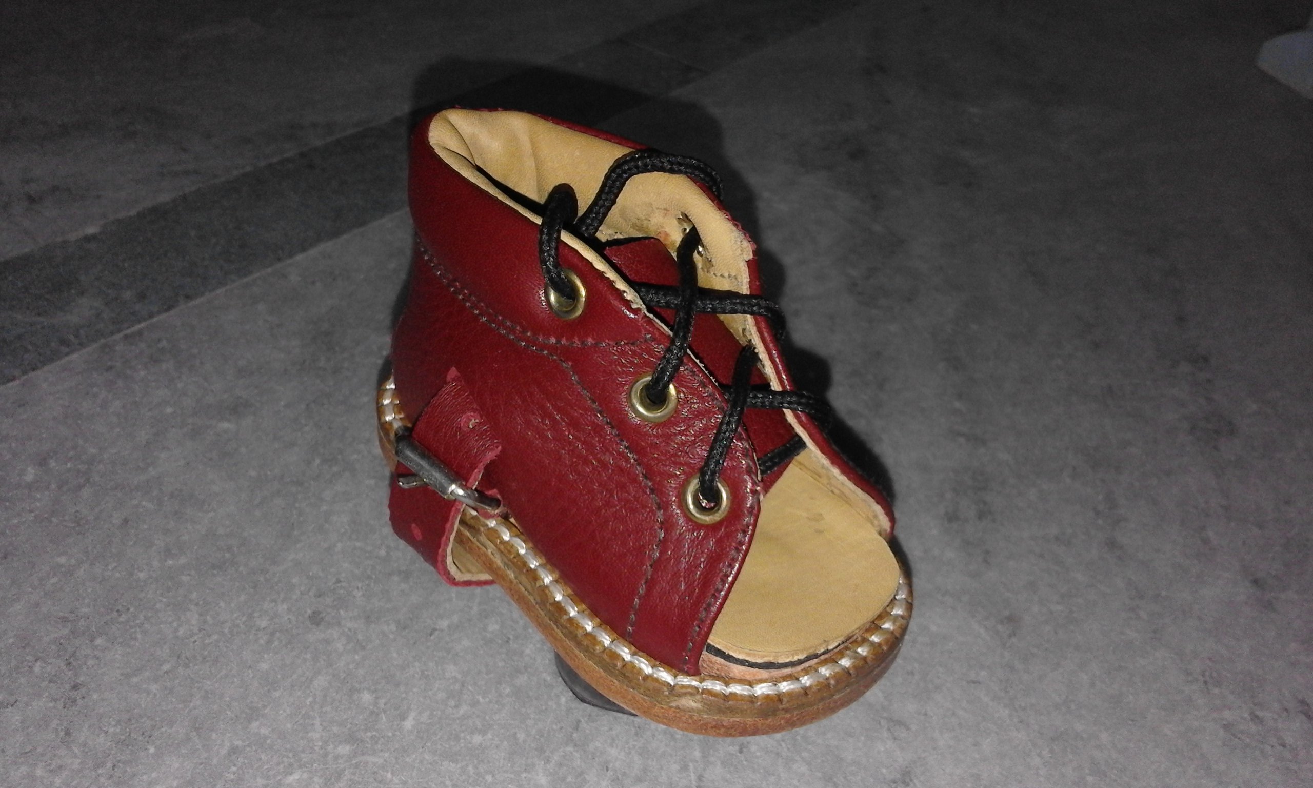 My Care Prosthetics And Orthotics Ctev Shoe For Post Club Foot Ctevshoe Antivarusshoe Antivarusctevshoe Orthopedicshoe Correctiveshoe T Co Bndhypygmd Twitter
